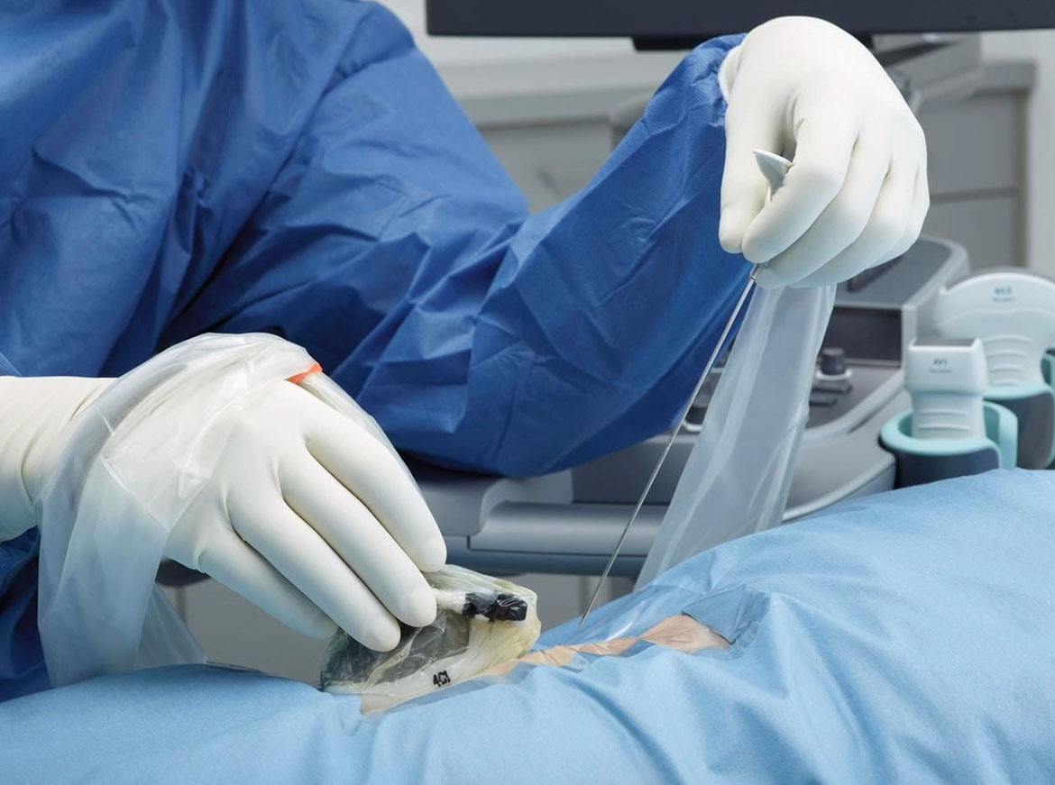 Врач хирург проводит операцию с иглой в руках